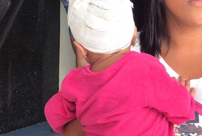 csm_crianca_baleada_na_cabeca_2_b5e2aa1584